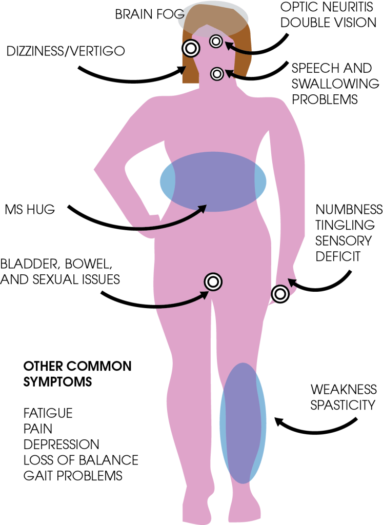 mssymptoms